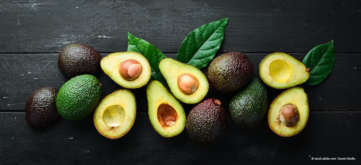 Avocado – lecker, gehaltvoll und gesund